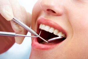 טיפולי שיניים בהריון- מותר או אסור?